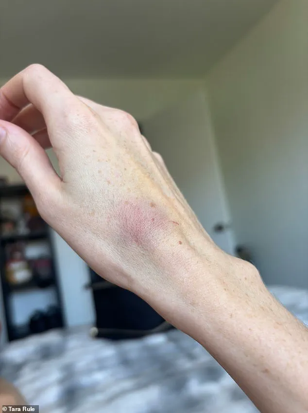 Tara Rule Claims American Airlines Refused to Assist with Carry-On, Leading to Hand Injury and Bruises