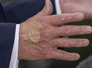 Trump's Defiance of Medical Advice on Aspirin Dosage Raises Expert Concerns