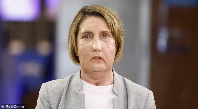 First Facial Transplant from Assisted Dying Donor Raises Ethical Questions