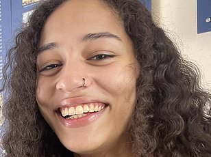 Fatal Pit Bull Attack Sparks Debate on Breed Aggression and Community Unity in Missouri