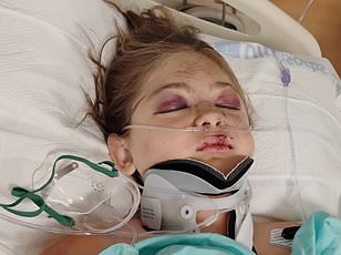 Idaho mother loses both legs in boating accident after tubing incident on Bear Lake.
