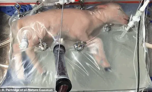 Growing Infants in an Artificial Womb: A Future of Hope or Fear?