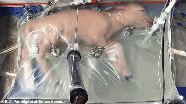 Growing Infants in an Artificial Womb: A Future of Hope or Fear?