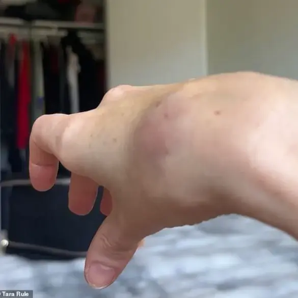 Tara Rule Claims American Airlines Refused to Assist with Carry-On, Leading to Hand Injury and Bruises
