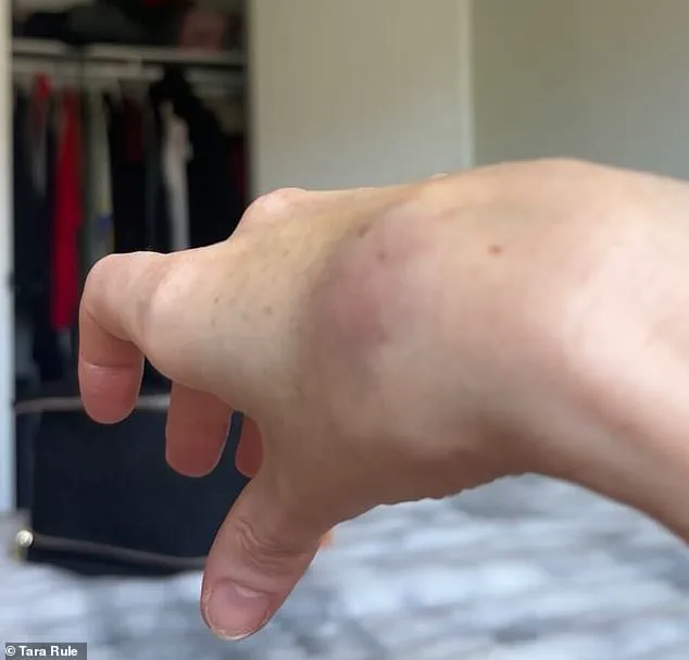 Tara Rule Claims American Airlines Refused to Assist with Carry-On, Leading to Hand Injury and Bruises
